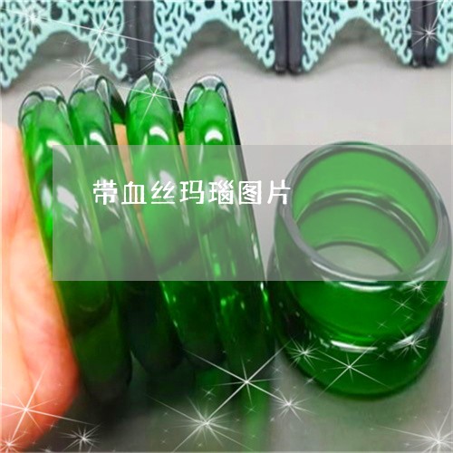 带血丝玛瑙图片/2023040385817