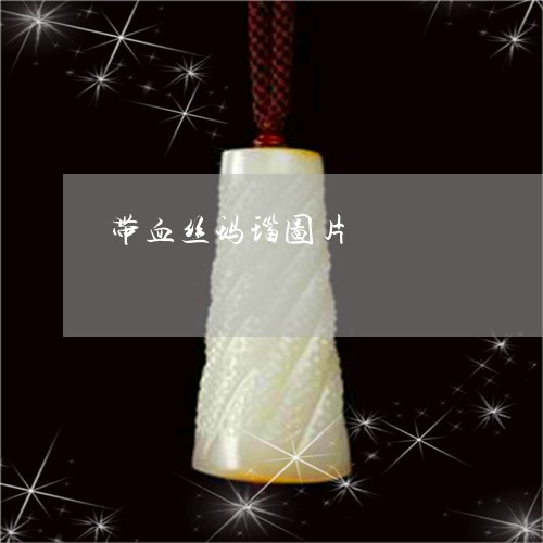 带血丝玛瑙图片/2023040391614