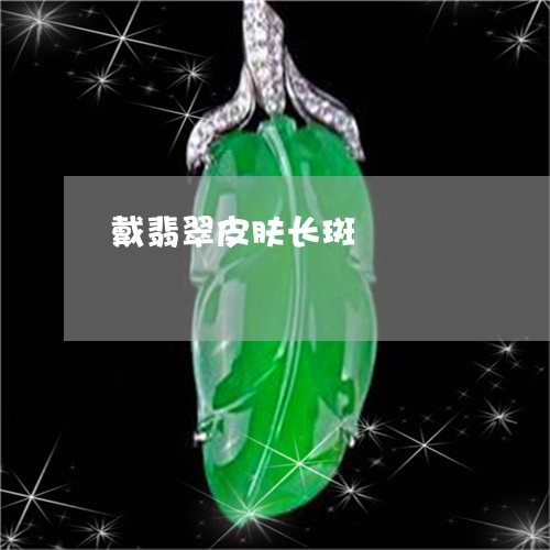 戴翡翠皮肤长斑/2023040216048