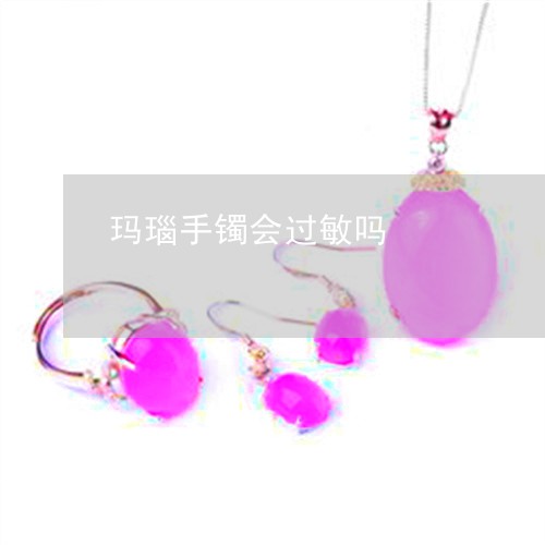 玛瑙手镯会过敏吗/2023031783027 玛瑙手镯会过敏吗/2023031783027