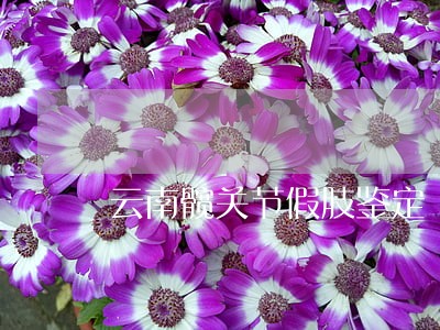 云南髋关节假肢鉴定 云南髋关节假肢鉴定