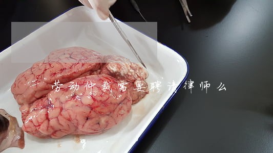 劳动仲裁需要聘请律师么