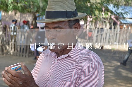 司法鉴定耳膜破裂属于几级伤残 司法鉴定耳膜破裂属于几级伤残