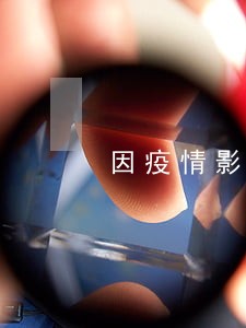 因疫情影响网贷逾期率 因疫情影响网贷逾期率