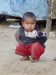 坡头工伤免费法律咨询 坡头工伤免费法律咨询
