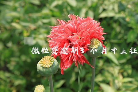 微粒贷逾期3个月才上征信吗