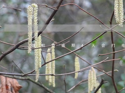 微粒贷逾期4天会打电话 微粒贷逾期4天会打电话