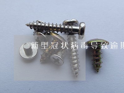 新型冠状病毒导致逾期 新型冠状病毒导致逾期