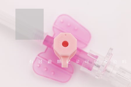 有过逾期记录可以考公吗 有过逾期记录可以考公吗