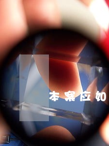 本案应如何适用诉讼时效质证技巧