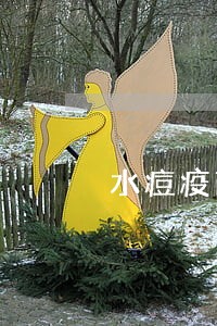 水痘疫苗逾期半年能打吗 水痘疫苗逾期半年能打吗