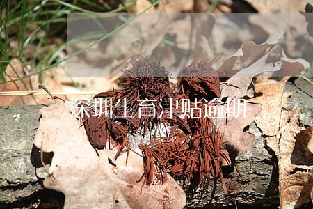 深圳生育津贴逾期 深圳生育津贴逾期