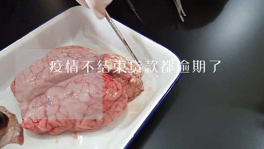 疫情不结束贷款都逾期了 疫情不结束贷款都逾期了