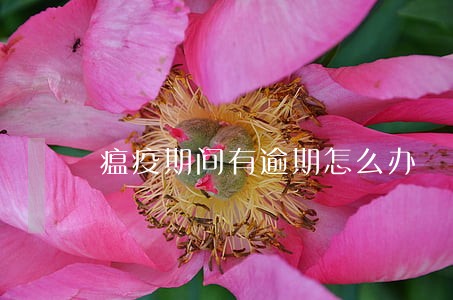 瘟疫期间有逾期怎么办 瘟疫期间有逾期怎么办