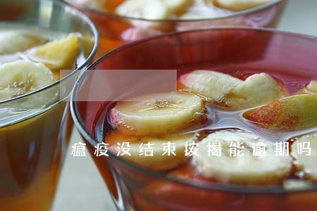 瘟疫没结束按揭能逾期吗 瘟疫没结束按揭能逾期吗
