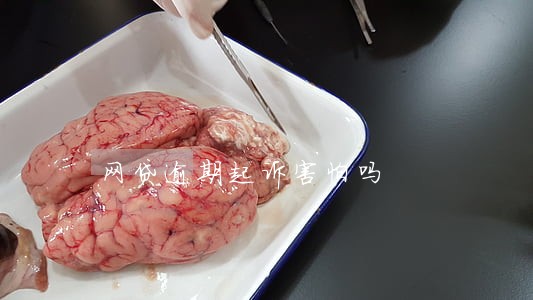 网贷逾期起诉害怕吗 网贷逾期起诉害怕吗