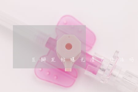 豆瓣发帖曝光渣男违法吗 豆瓣发帖曝光渣男违法吗