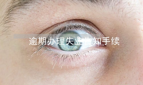 逾期办理失业告知手续 逾期办理失业告知手续