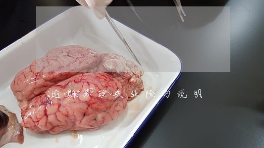 逾期办理失业险的说明 逾期办理失业险的说明