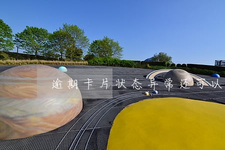 逾期卡片状态异常还可以借现金吗 逾期卡片状态异常还可以借现金吗