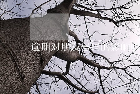 逾期对朋友号码的影响吗 逾期对朋友号码的影响吗