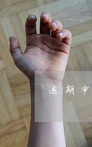 逾期申报需带什么资料 逾期申报需带什么资料