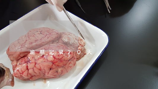 逾期记录20天
