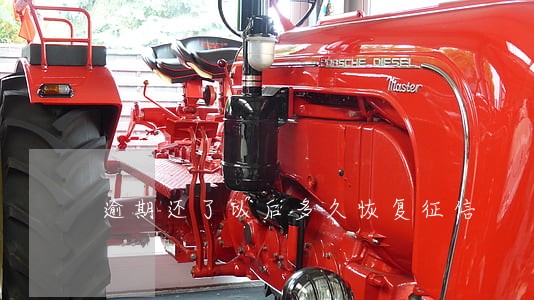 逾期还了以后多久恢复征信 逾期还了以后多久恢复征信