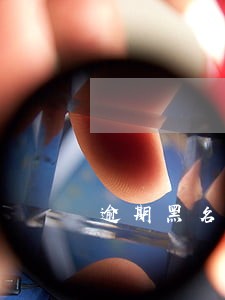 逾期黑名单多久恢复贷款 逾期黑名单多久恢复贷款
