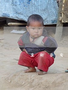 重新鉴定轻伤法律有没有限制 重新鉴定轻伤法律有没有限制