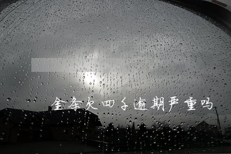 金条欠四千逾期严重吗 金条欠四千逾期严重吗