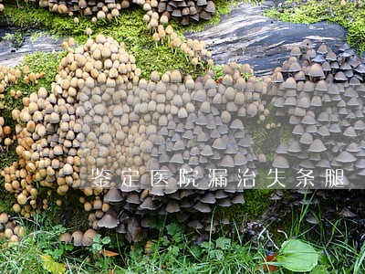 鉴定医院漏治失条腿 鉴定医院漏治失条腿