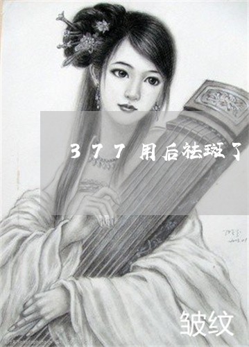 377用后祛斑了不用会不会反弹 377用后祛斑了不用会不会反弹