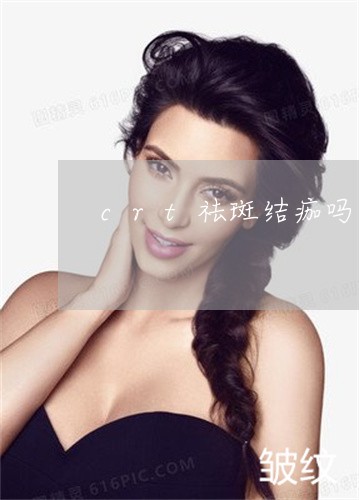 crt祛斑结痂吗 crt祛斑结痂吗