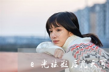 e光祛斑后几天可以洗脸 e光祛斑后几天可以洗脸