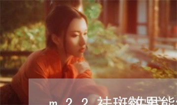 m22祛斑效果能维持多久