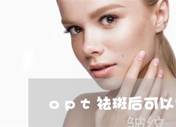 opt祛斑后可以打水光针吗