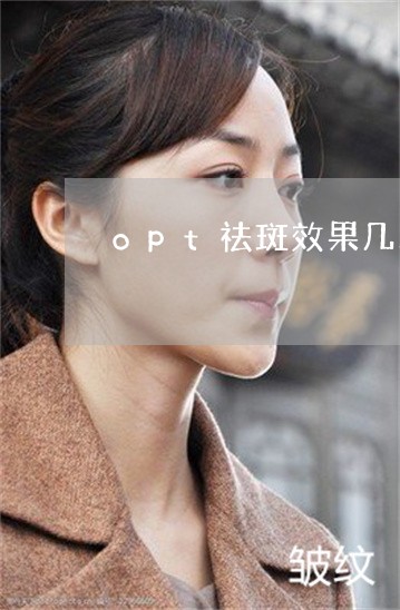 opt祛斑效果几次一疗程