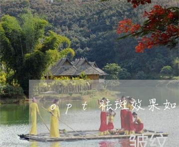 opt祛斑效果如何 opt祛斑效果如何