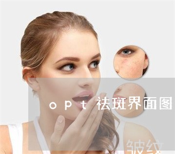 opt祛斑界面图片