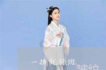 一撕就祛斑