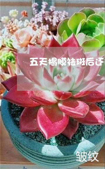 五天揭膜祛斑后还能做皮秒吗