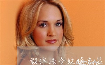 假体法令纹填充显的老婆嘴