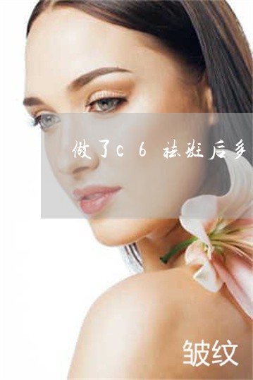 做了c6祛斑后多久斑可以代谢