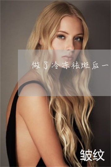 做了冷冻祛斑后一直张黄褐斑