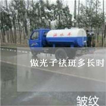 做光子祛斑多长时间可以洗脸