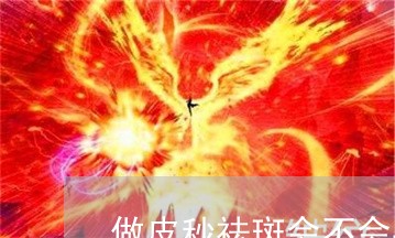 做皮秒祛斑会不会导致月经失调 做皮秒祛斑会不会导致月经失调