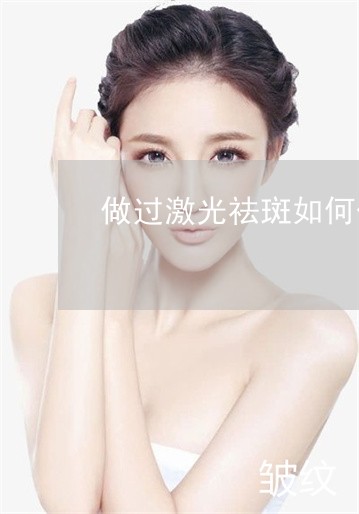 做过激光祛斑如何保养 做过激光祛斑如何保养