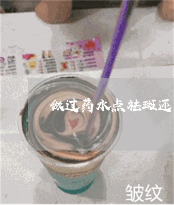 做过药水点祛斑还可以再做吗