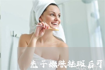 光子嫩肤祛斑后可以涂芦荟胶吗 光子嫩肤祛斑后可以涂芦荟胶吗